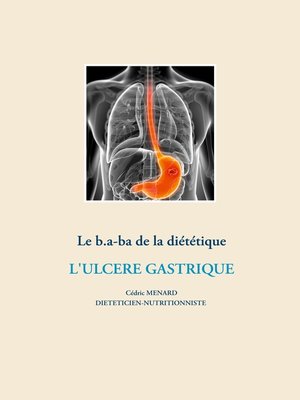cover image of Le b.a-ba de la diététique pour l'ulcère gastrique